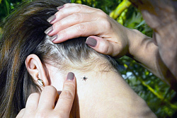 Памятка при укусах клещей! Пошаговый алгоритм для пострадавших